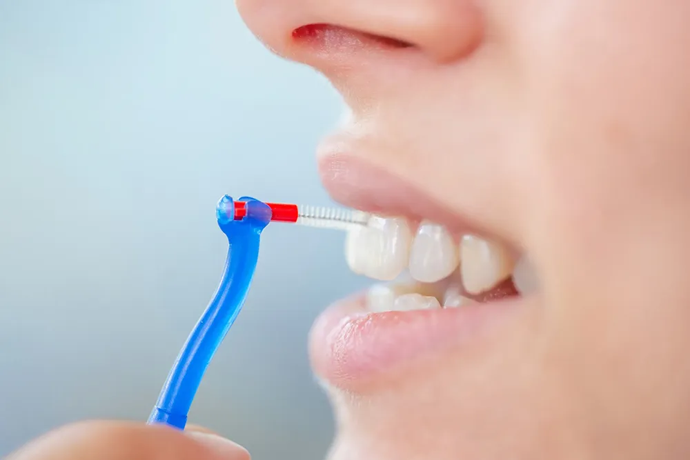 Cara Menggunakan Sikat Interdental yang Benar